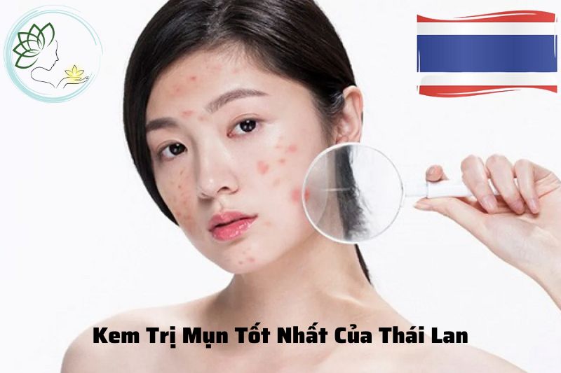 Top 11 Kem Trị Mụn Tốt Nhất Của Thái Lan